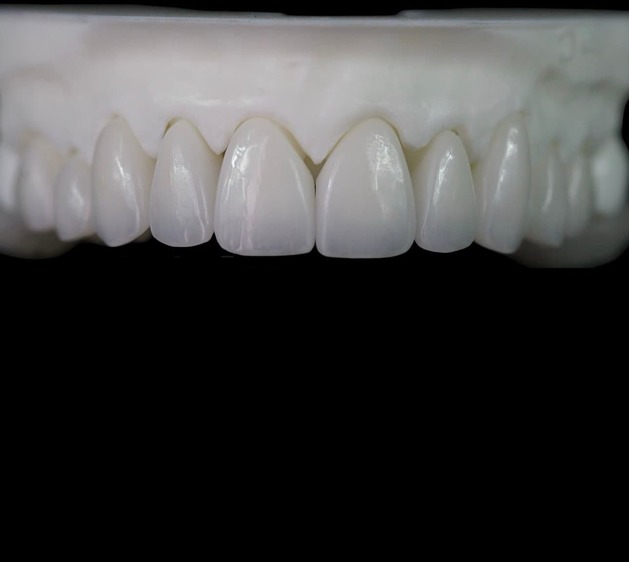 Precision restoration