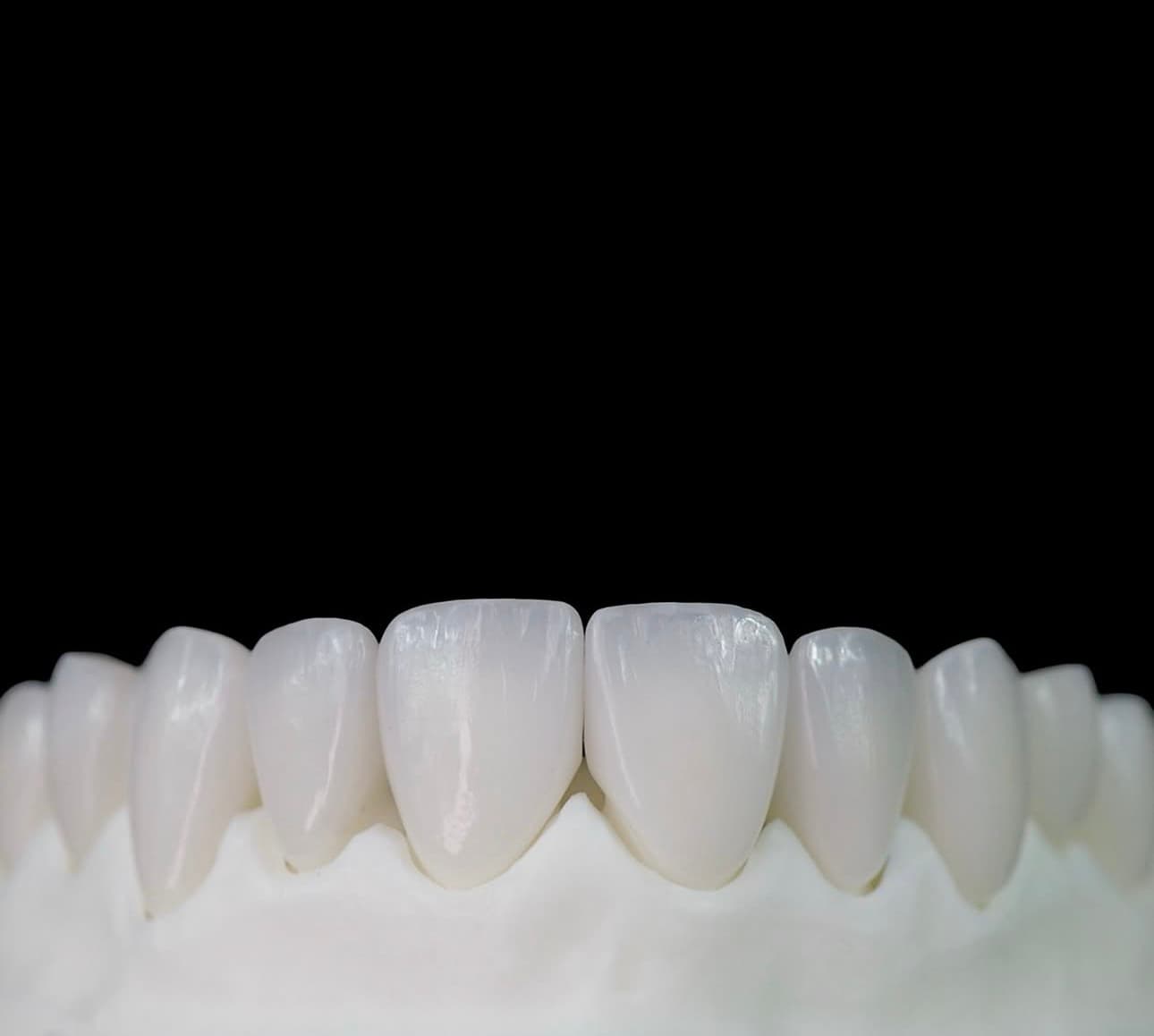 Hand-crafted veneer detail